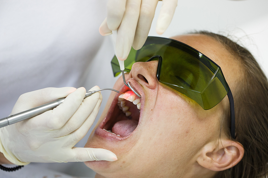 The Benefits of Laser Treatment in Modern Dentistry