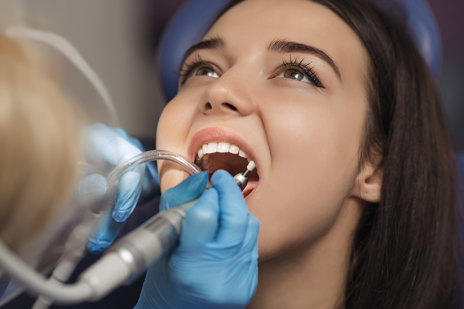 What to Expect After a Wisdom Tooth Extraction: A Comprehensive Guide